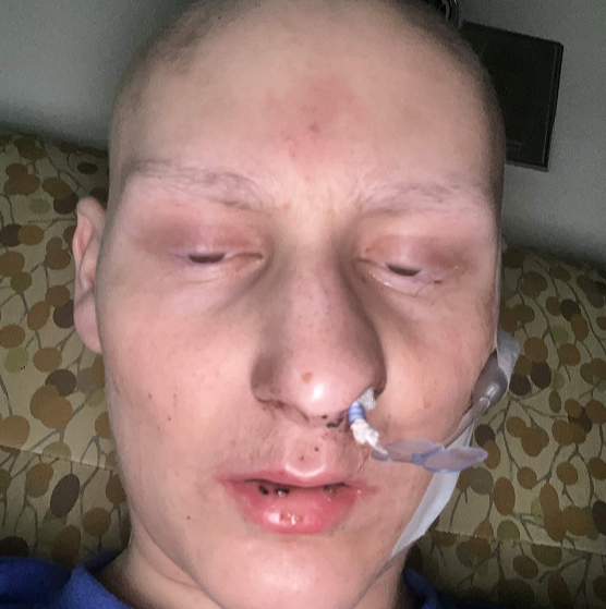 fuckcancer